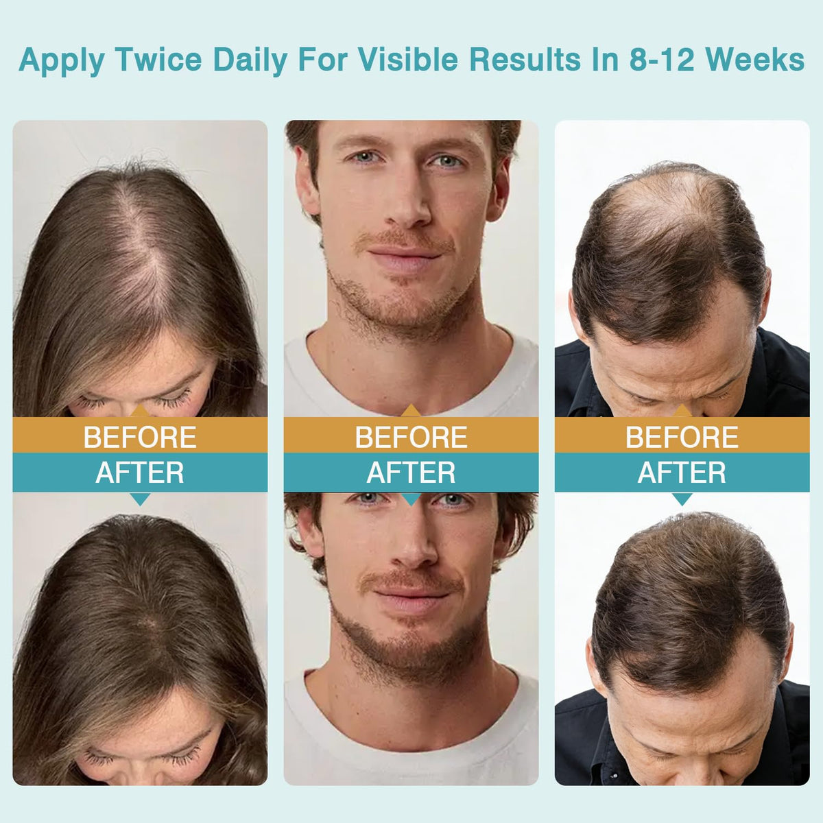 Generic brand applying cream to scalp for even distribution and massage