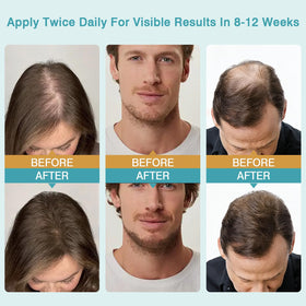 Generic brand applying cream to scalp for even distribution and massage