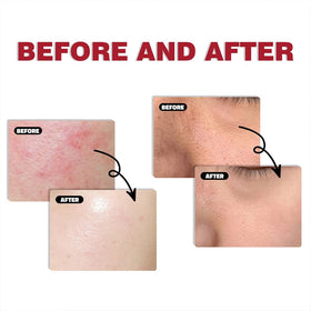 Generic sunscreen tucked in a daypack for outdoor use and easy reapplication