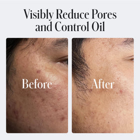 Geologie salicylic acid ingredient visual illustrating pore-exfoliating benefit