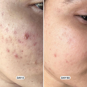 Geologie salicylic acid ingredient close-up highlighting exfoliation