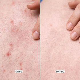 Geologie gel texture closeup highlighting exfoliating acids benefit