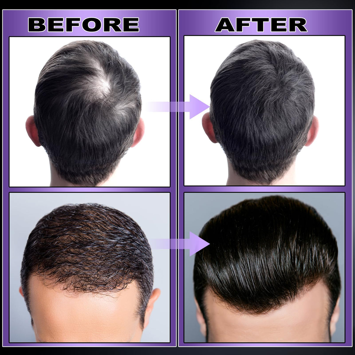 gifbea arranged biotin and castor oil ingredients for strengthened roots