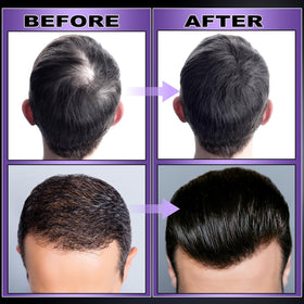 gifbea arranged biotin and castor oil ingredients for strengthened roots
