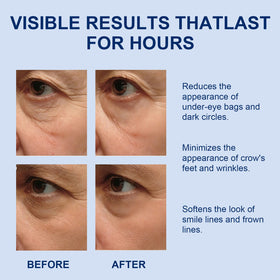 GingLePrune application under-eye showing quick setting film and immediate smoothing benefit