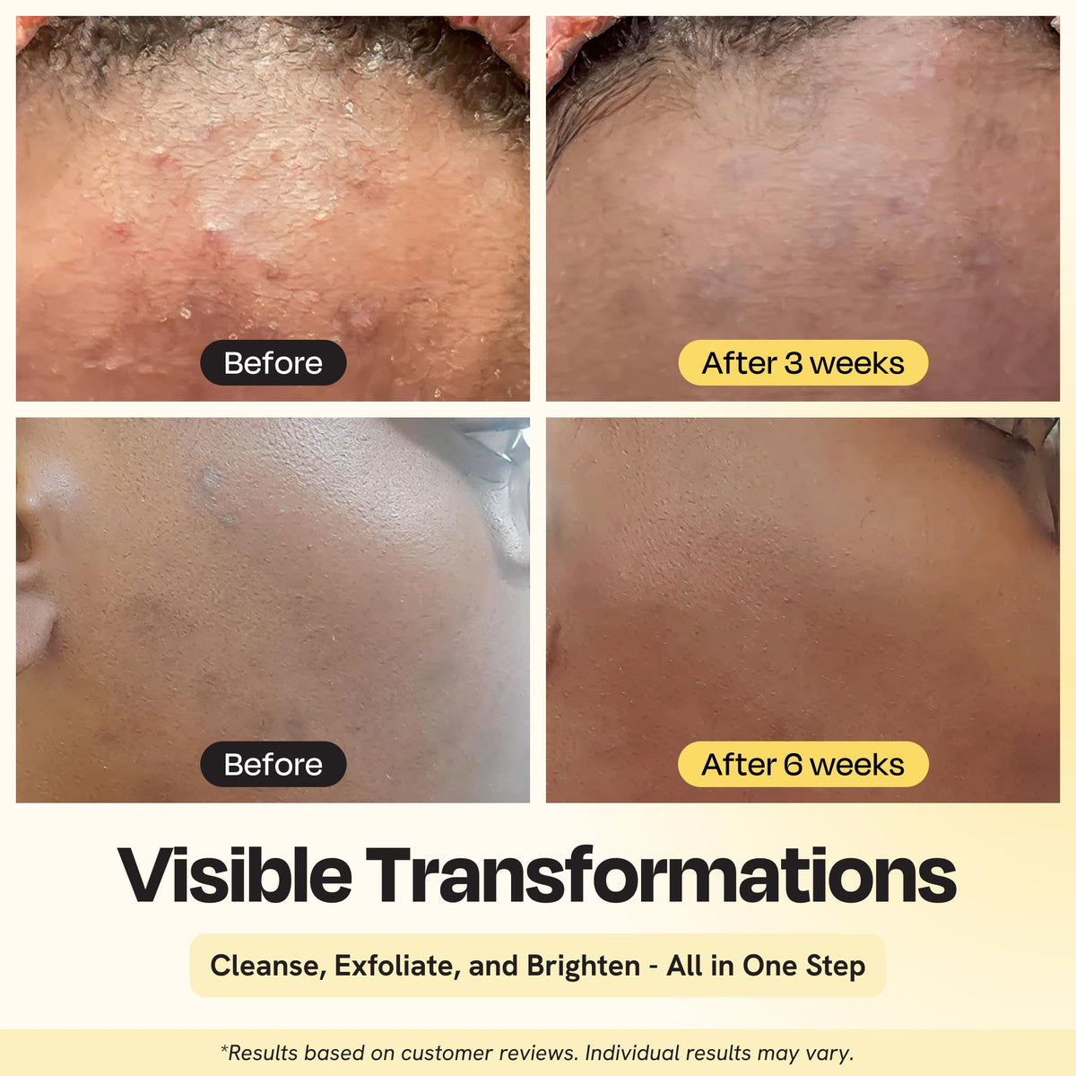 Gleamin creamy foam texture demonstrating gentle cleansing benefit