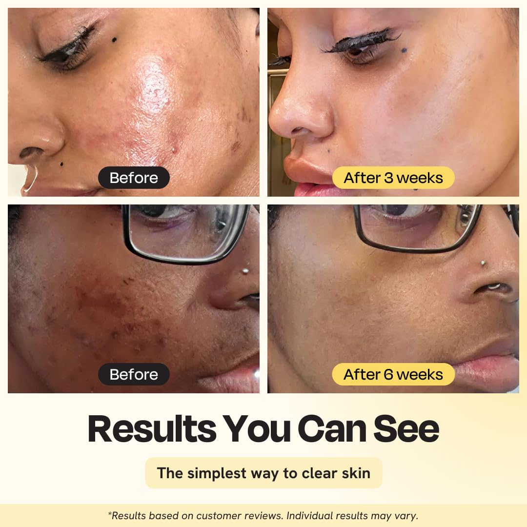 Gleamin mask creamy texture close-up highlighting smooth application