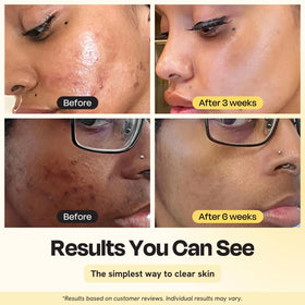 Gleamin mask creamy texture close-up highlighting smooth application