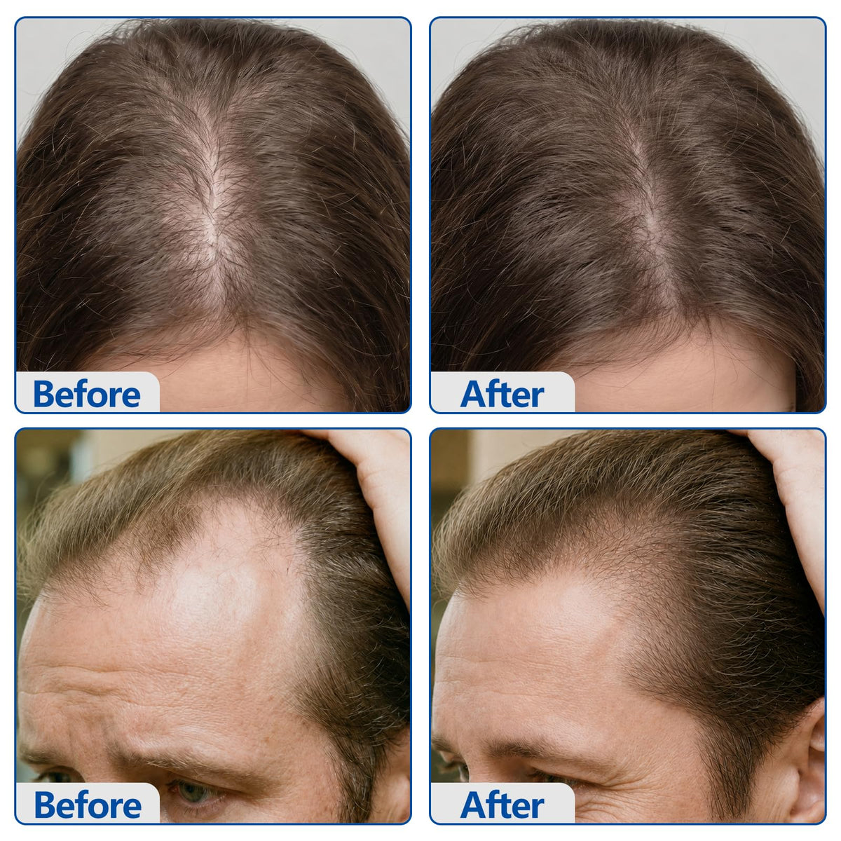 Glemme before and after styled hair showing improved fullness appearance
