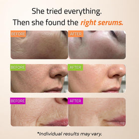 GLEOW hyaluronic acid droplet on hand demonstrating instant hydration boost