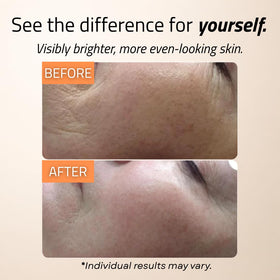 GLEOW ingredient list close-up highlighting vitamin C, hyaluronic acid benefits