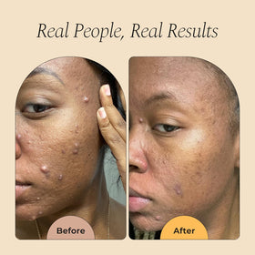 Glo Melanin airy foam texture on hand illustrating soft cleansing and hydration