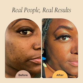 Glo Melanin open jar revealing golden scrub texture for nourishing skin renewal