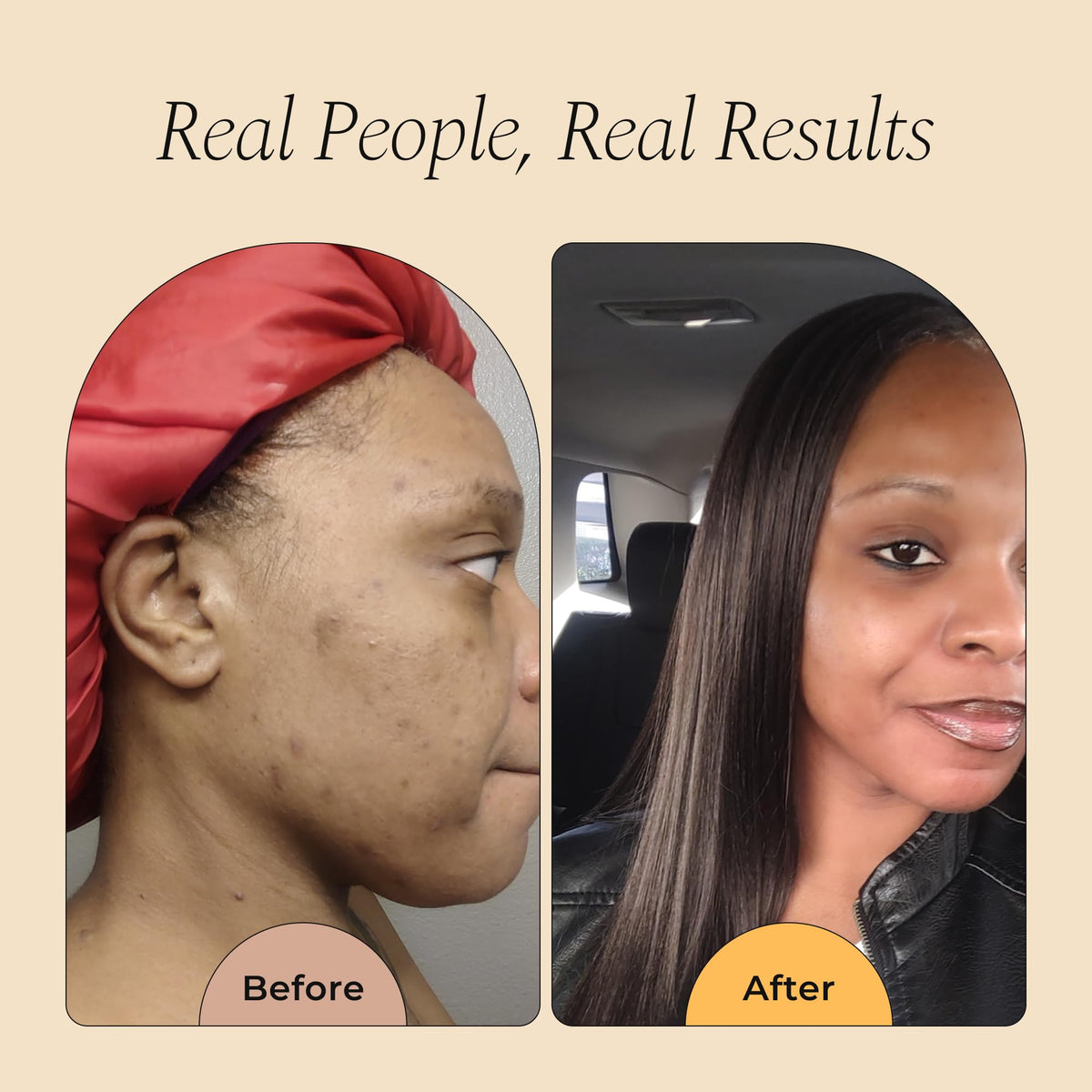 Glo Melanin oil texture on fingertip demonstrating quick absorption and glow