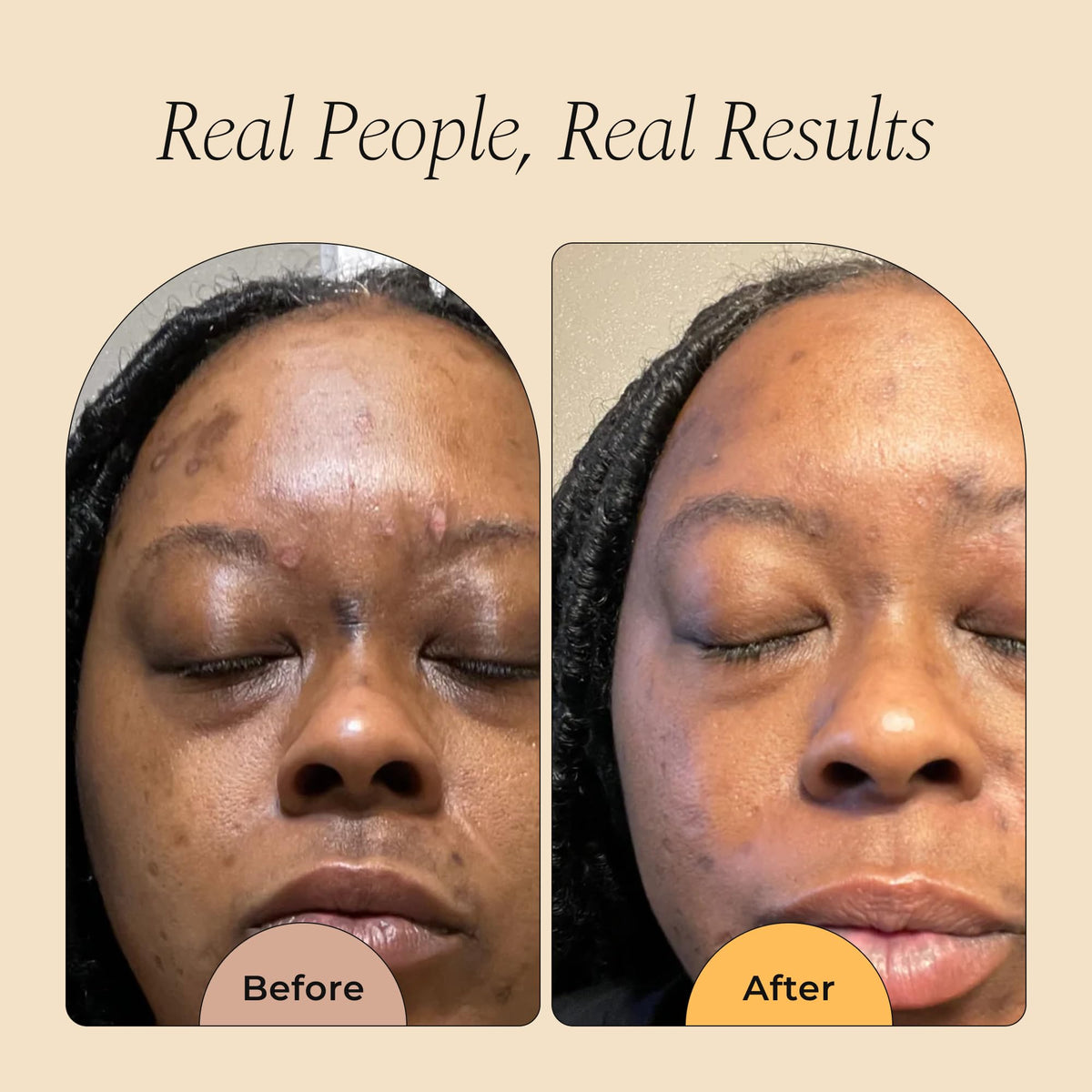 Glo Melanin serum texture on skin showing lightweight absorption benefit
