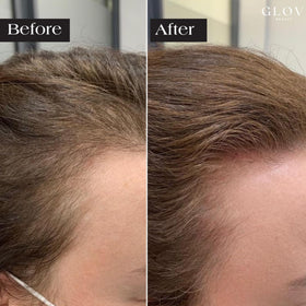 Glov Beauty applicator in hand demonstrating ergonomic control