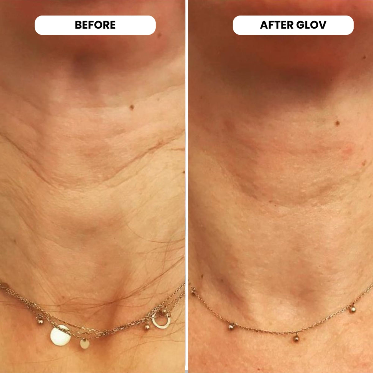 Glov Beauty stamp in use on cheek demonstrating gentle tapping application
