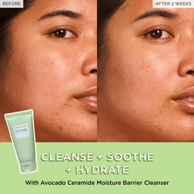 Glow Recipe ingredient-focused shot highlighting avocado oil and ceramide boosters