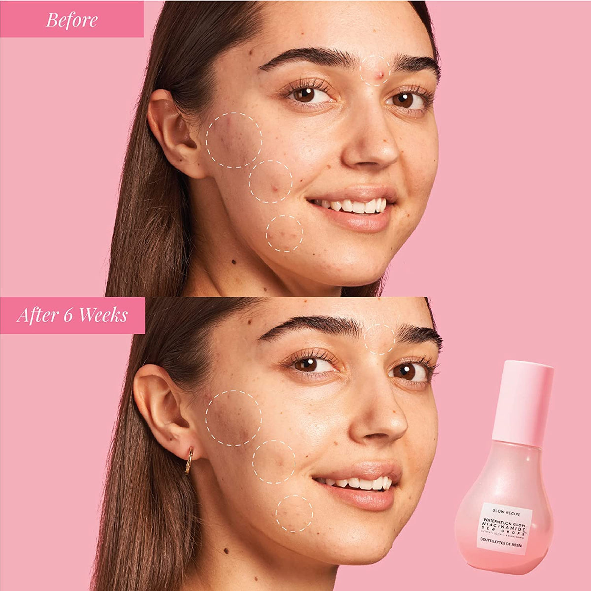 Glow Recipe applied on cheek as highlighter showing dewy luminosity benefit