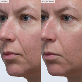 Glow Recipe before and after close-up illustrating visible plumping and smoother texture