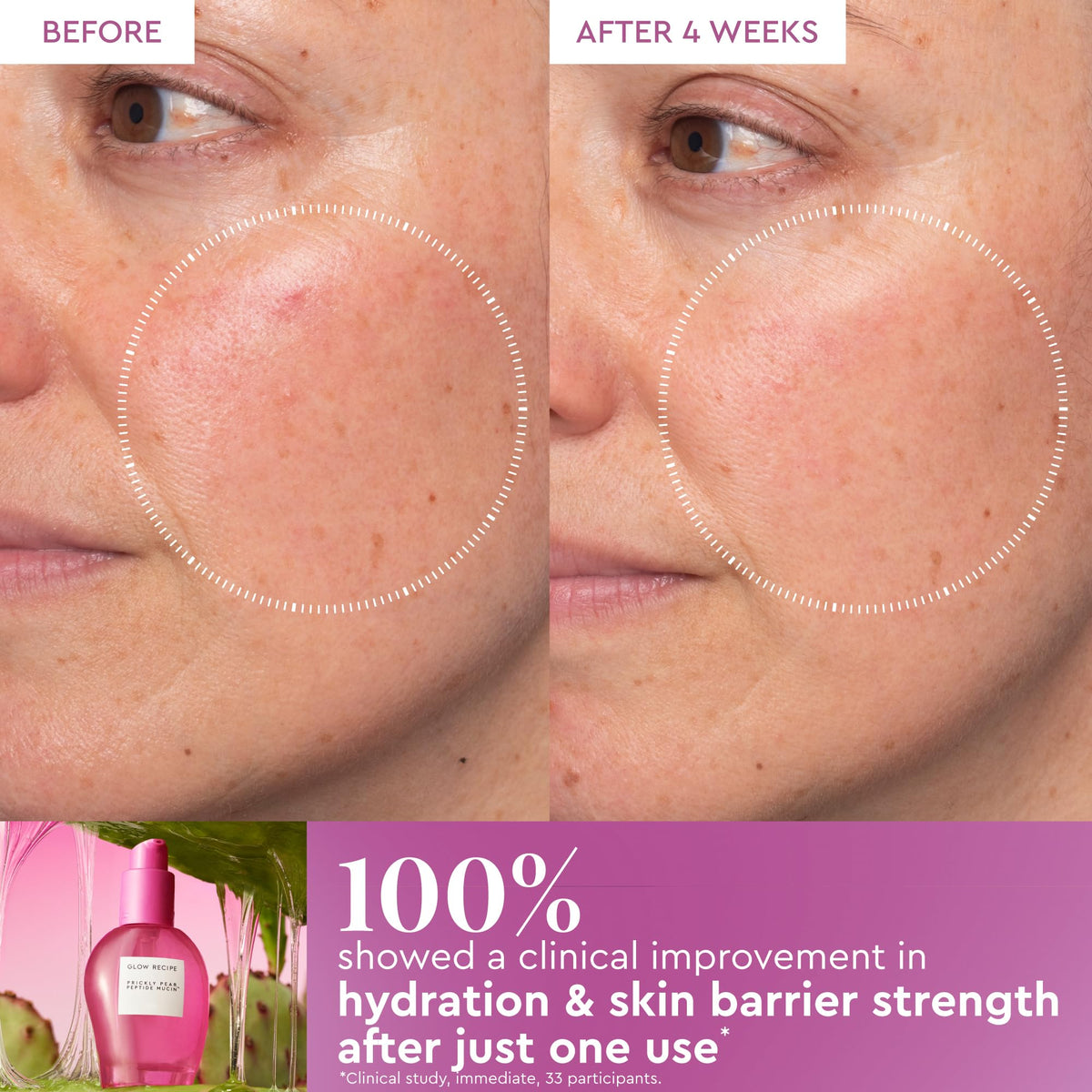Glow Recipe closeup of prickly pear ingredient highlighting botanical moisture benefits