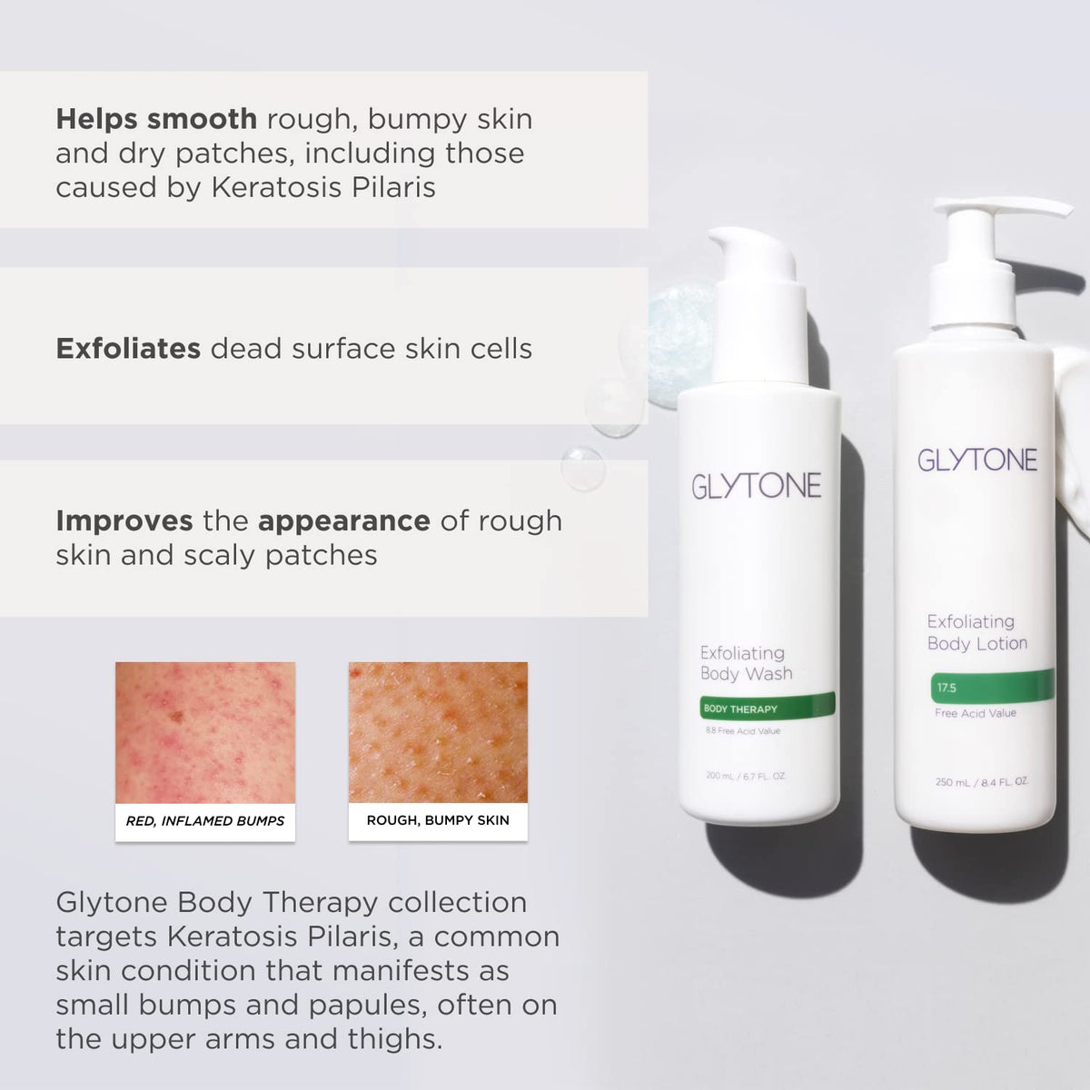 GLYTONE bottle next to hand showing 8.4 fl oz size for scale