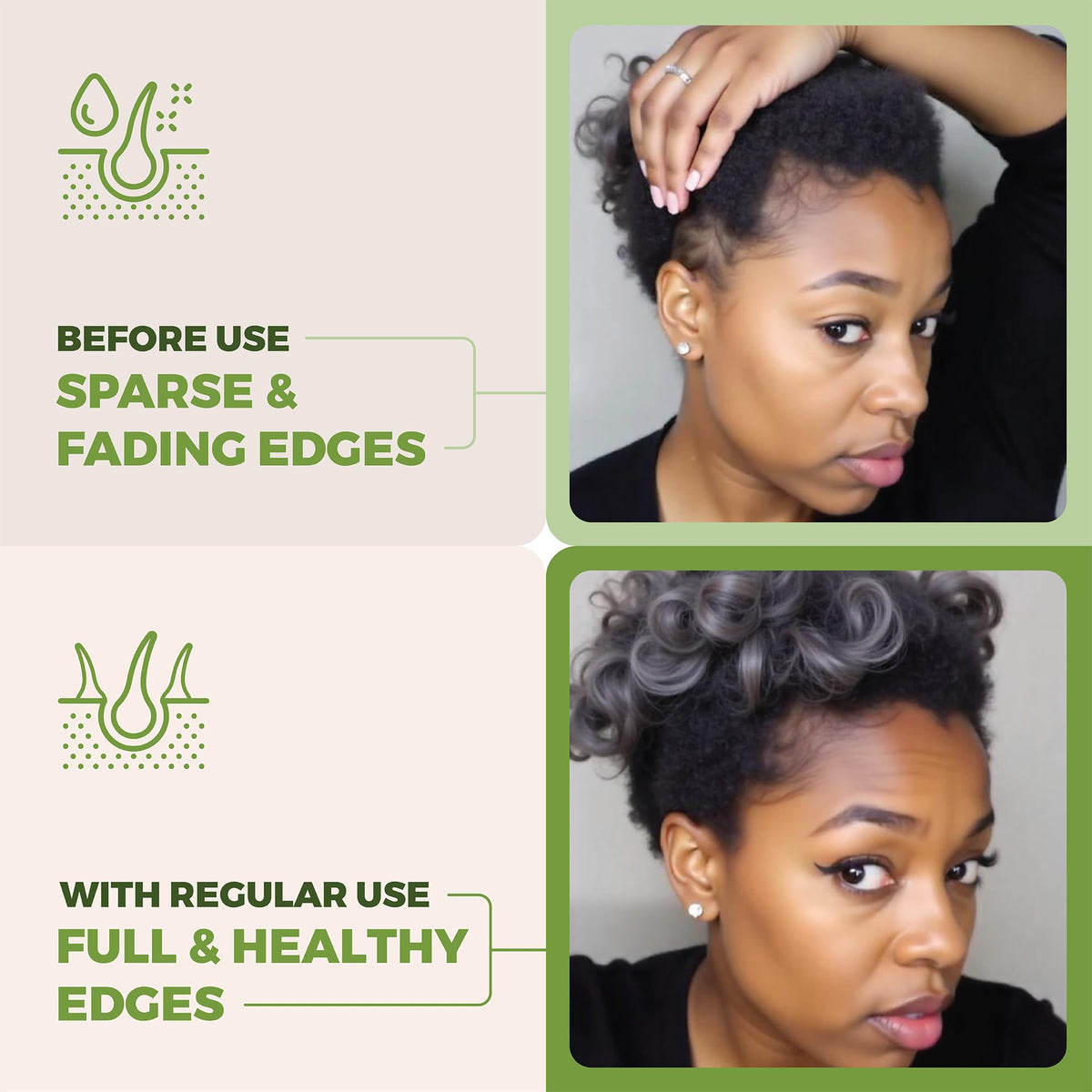 Going Batanas being massaged into scalp to boost circulation and nourishment