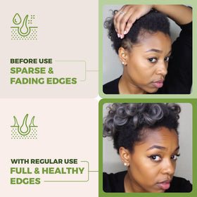 Going Batanas being massaged into scalp to boost circulation and nourishment