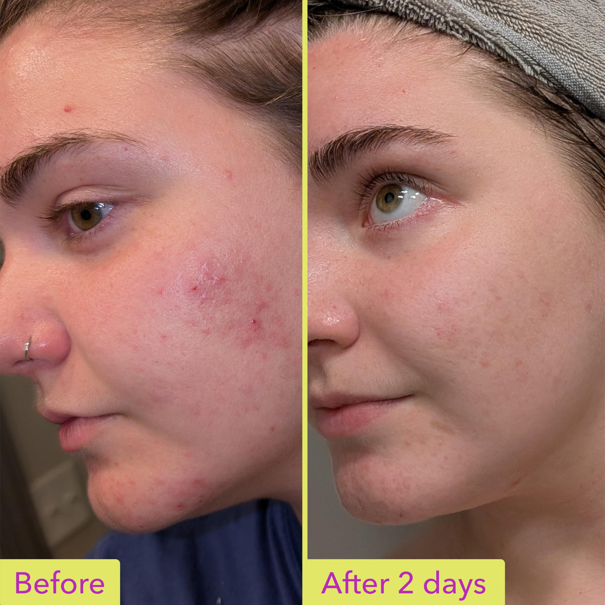 Good Molecules texture close-up drop showing lightweight absorption benefit