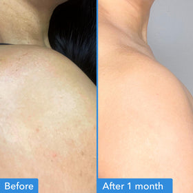 Good Molecules cream being applied on arm demonstrating targeted spot treatment
