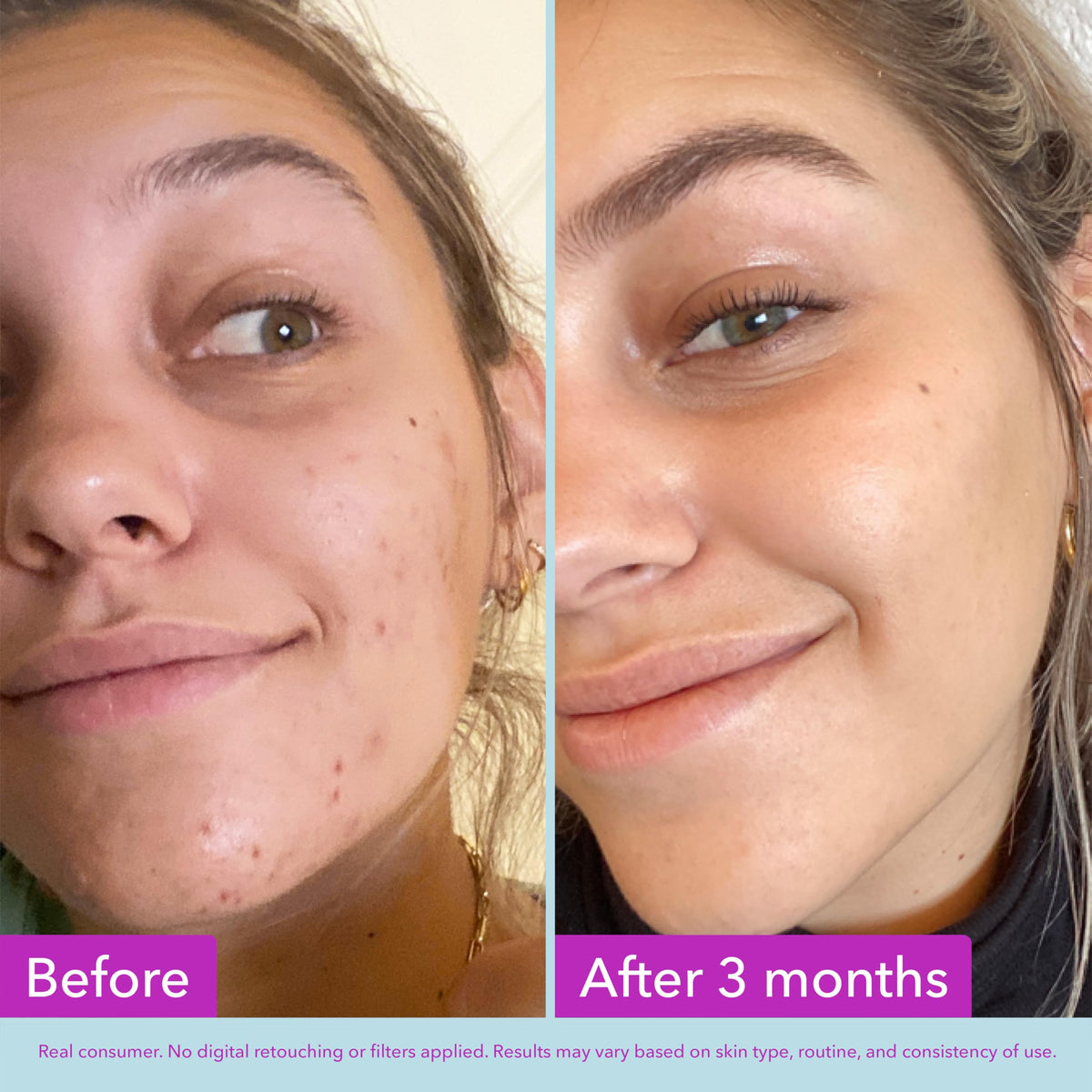 Good Molecules ingredient display with niacinamide and arbutin for even tone