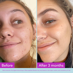Good Molecules ingredient display with niacinamide and arbutin for even tone