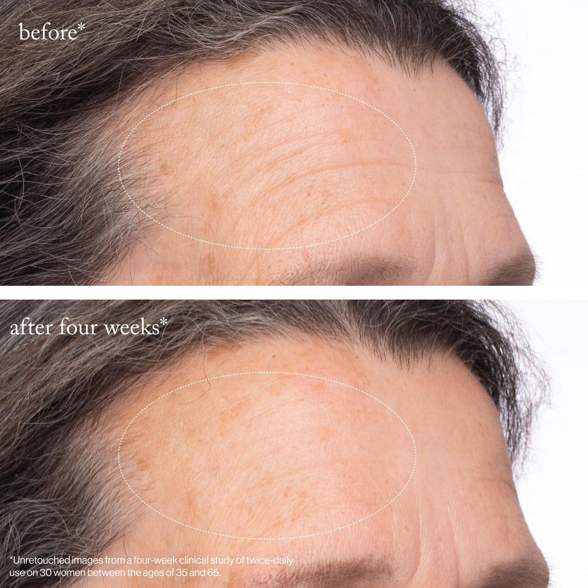 goop timeline graphic illustrating before and after four weeks showing visible firmness benefit