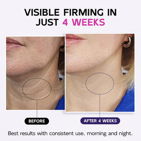 GOOSURE cream texture on fingertip, demonstrates hydrating hyaluronic, smoothing look