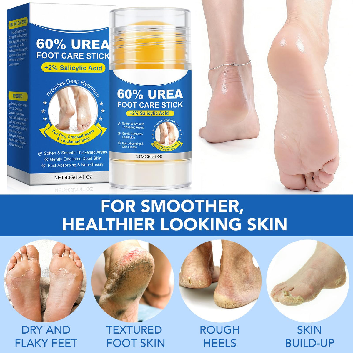 GPUPFJPW applying the urea stick to a cracked heel for targeted callus softening