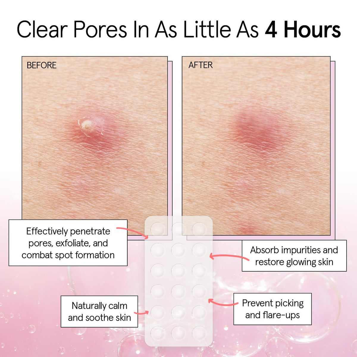 grace & stella patch applied on cheek demonstrating discreet coverage and protection
