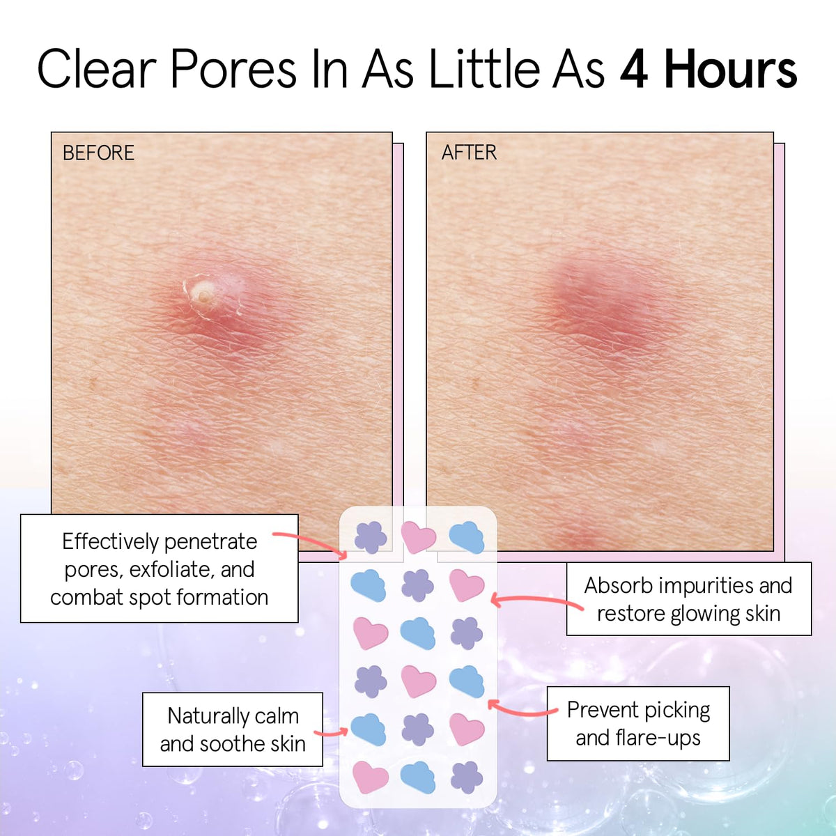 grace & stella patch applied on cheek demonstrating protective coverage and reduced picking