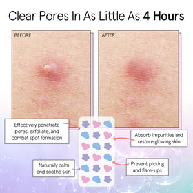 grace & stella patch applied on cheek demonstrating protective coverage and reduced picking