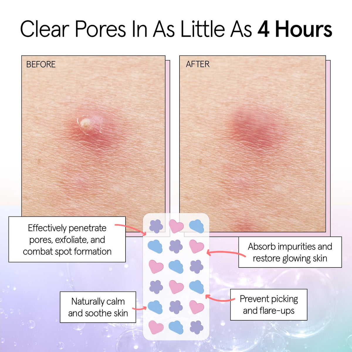 grace & stella patch applied to cheek, invisible coverage and confidence