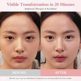 GrlGrl patch on under-eye during morning routine reduces puffiness fast