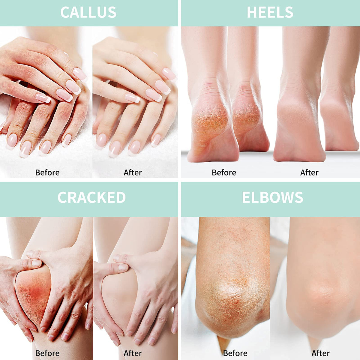 Grocerism applying cream to foot demonstrating deep moisturize benefit
