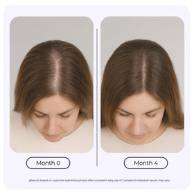 GROWPLEX ingredients display illustrating biotin, collagen and vitamins