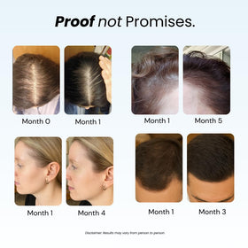 Growplex cream texture on hand showing lightweight hydration and smoothness