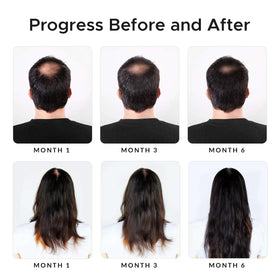Growth Essence example before and after hair visual implying fuller-looking hair