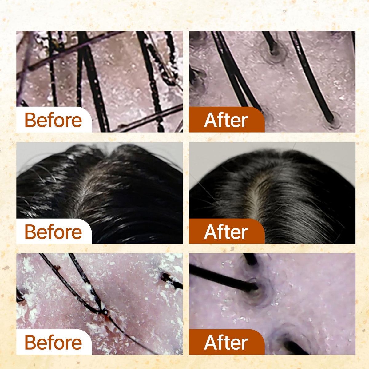 GROWUS shampoo lathering on hair in shower for clarifying cleanse