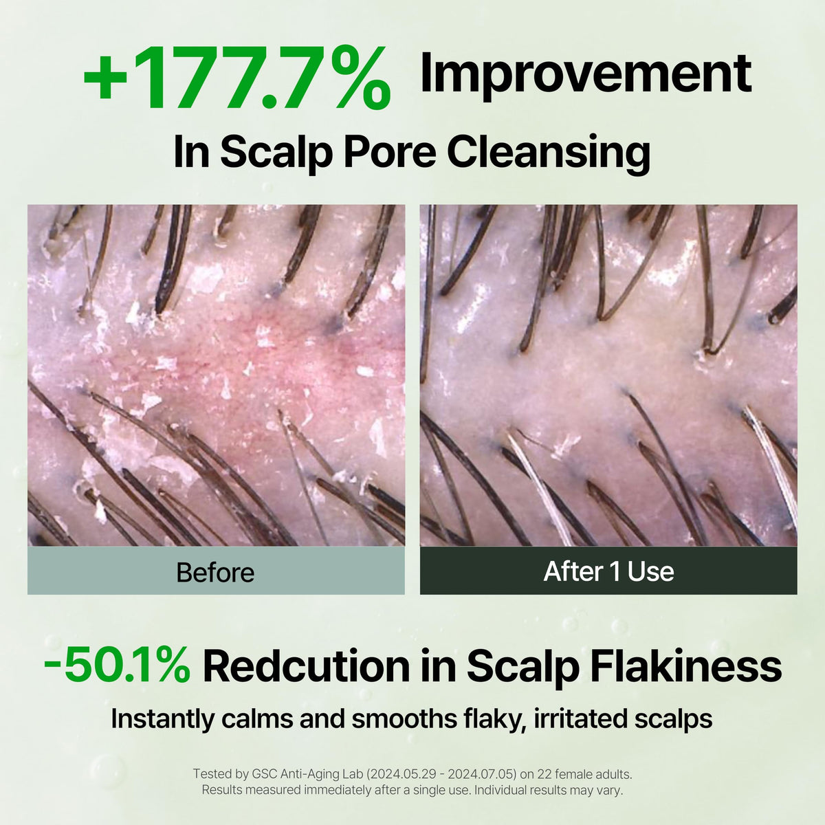 GROWUS shampoo lather on scalp illustrating soothing and lift