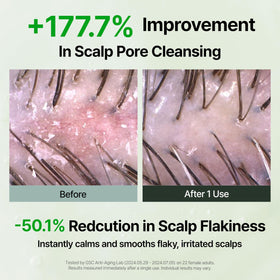 GROWUS shampoo lather on scalp illustrating soothing and lift