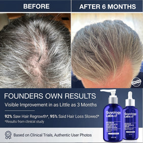 Guyology Labs AnaGain and biotin ingredient display showcasing active support