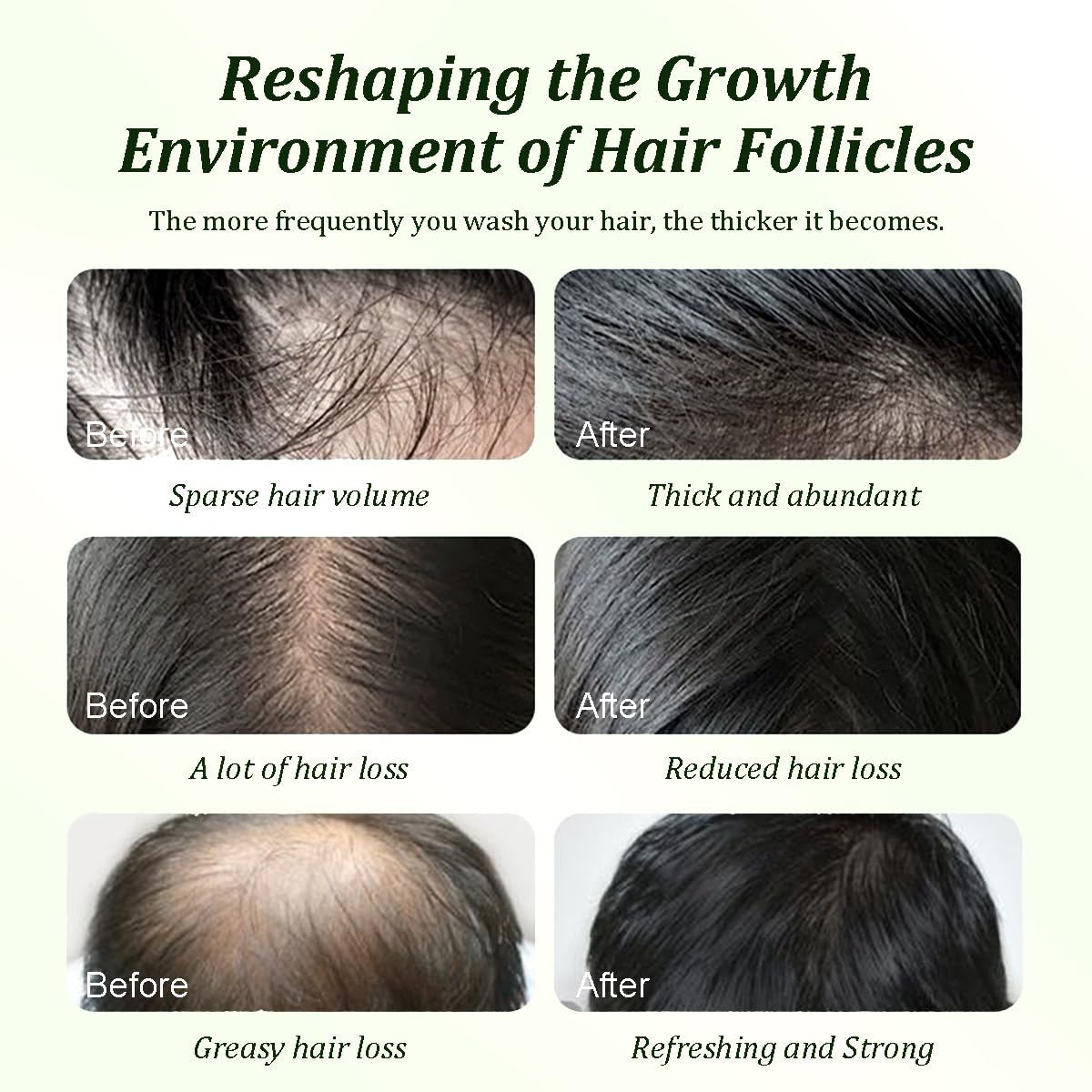 Man using Gypsophila shampoo during scalp massage improving scalp health