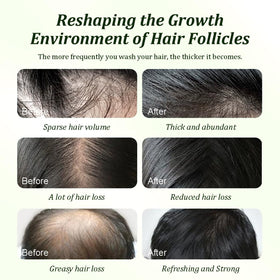 Man using Gypsophila shampoo during scalp massage improving scalp health